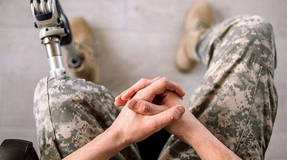 Для УБД Уряд спростив доступ до високотехнологічних протезів