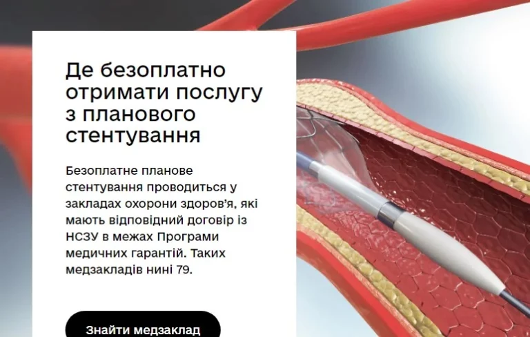 Безоплатне планове стентування судин серця