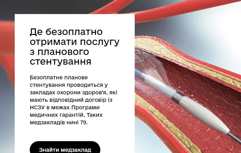 Безоплатне планове стентування судин серця